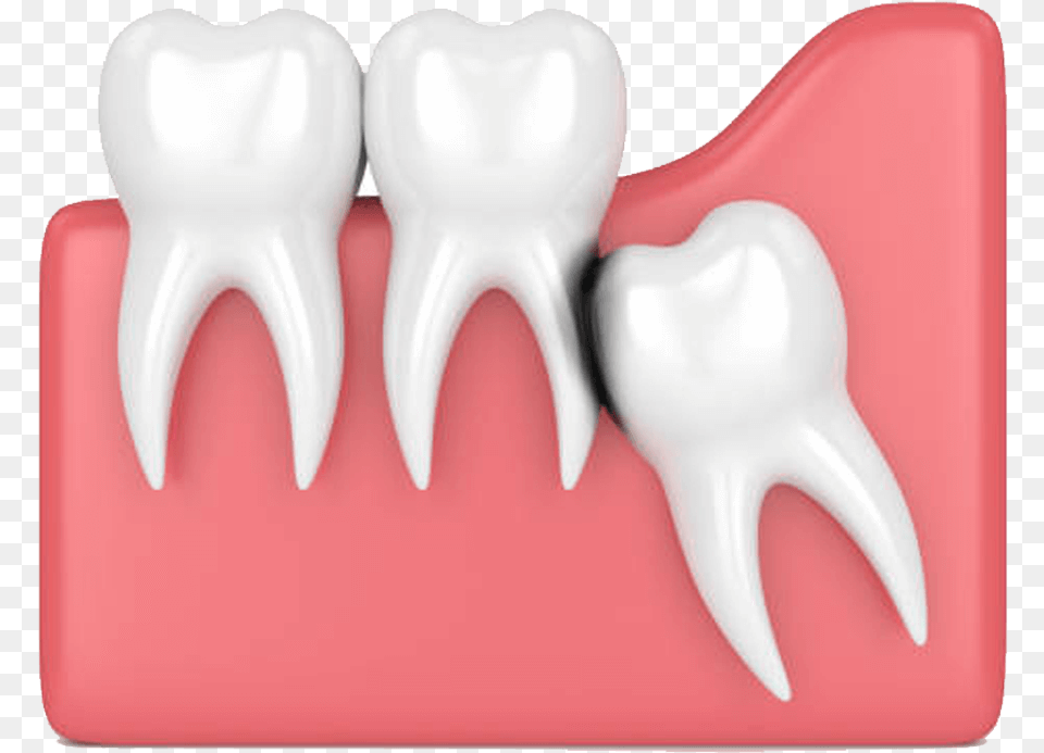Wisdom Teeth, Body Part, Mouth, Person Png Image