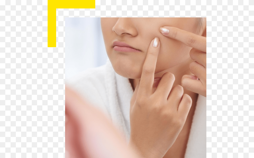 Woman Popping Pimple, Adult, Female, Person, Face Free Png Download