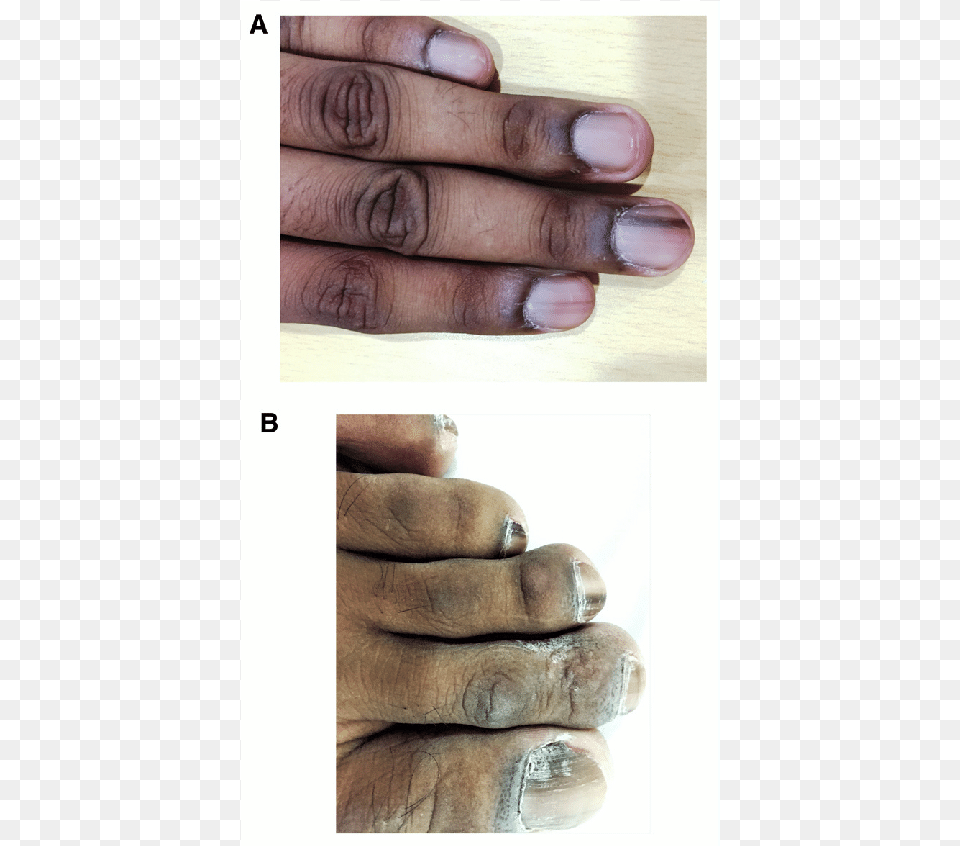 Wood, Body Part, Finger, Hand, Nail Free Png