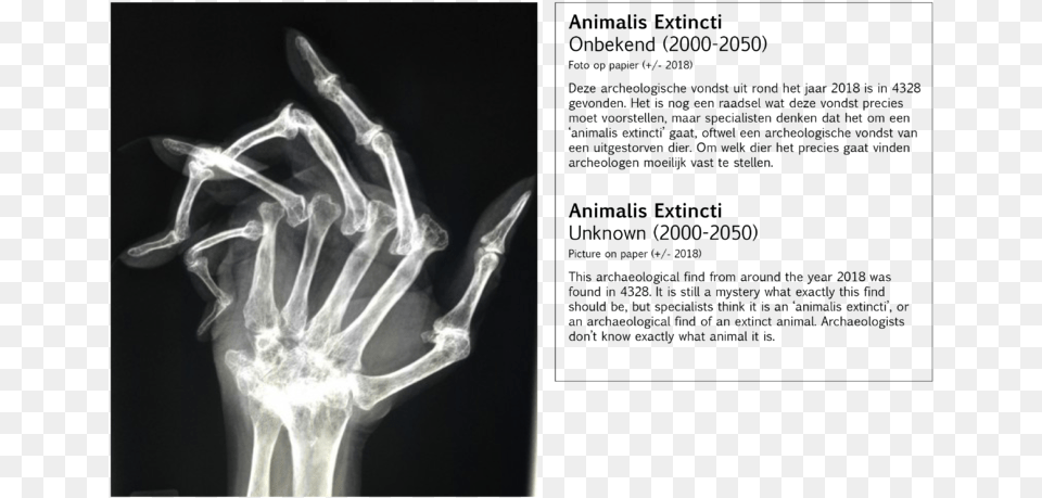 Worst Hand X Ray, X-ray Png Image