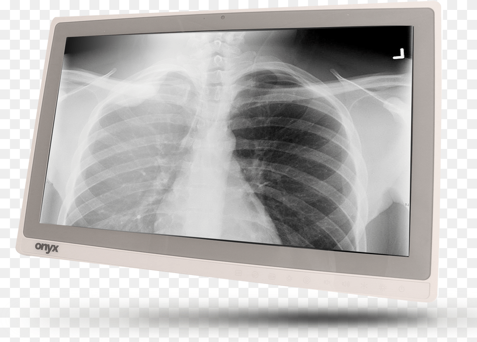 X Ray, Screen, Electronics, Monitor, Computer Hardware Png