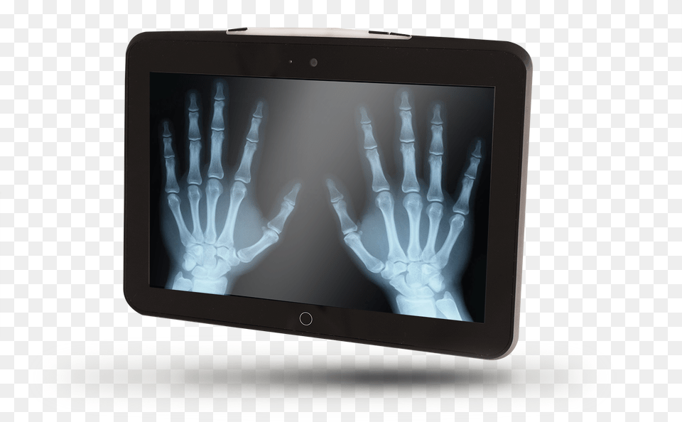 X Ray, Computer, Electronics, Tablet Computer, X-ray Free Png Download