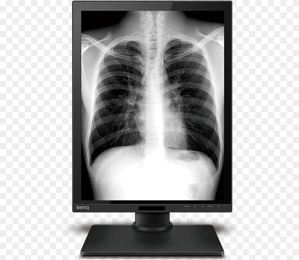 X Ray, Hardware, Computer Hardware, Electronics, Screen Free Transparent Png