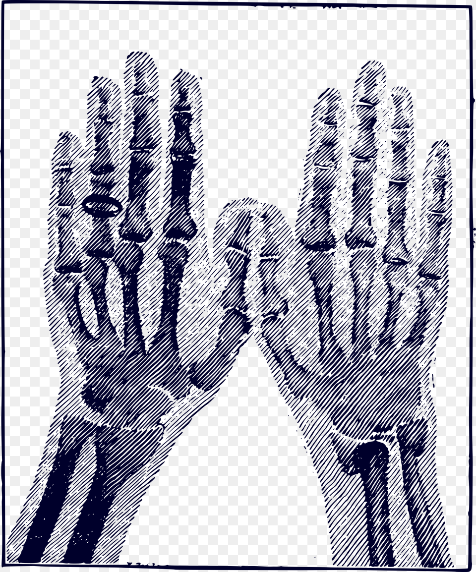 X Ray Clip Arts Clipart X Ray, Clothing, Glove, Body Part, Hand Free Png Download