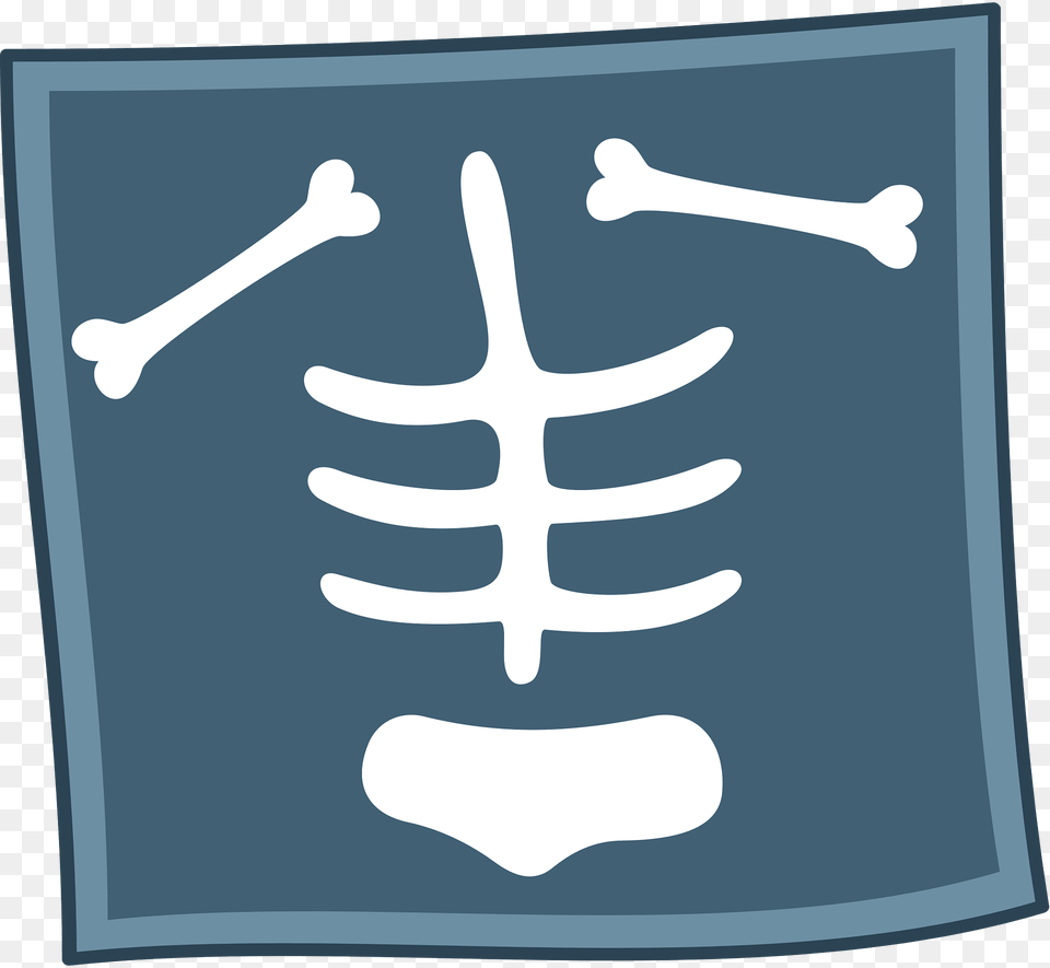 X Ray Clipart, Blackboard Free Transparent Png