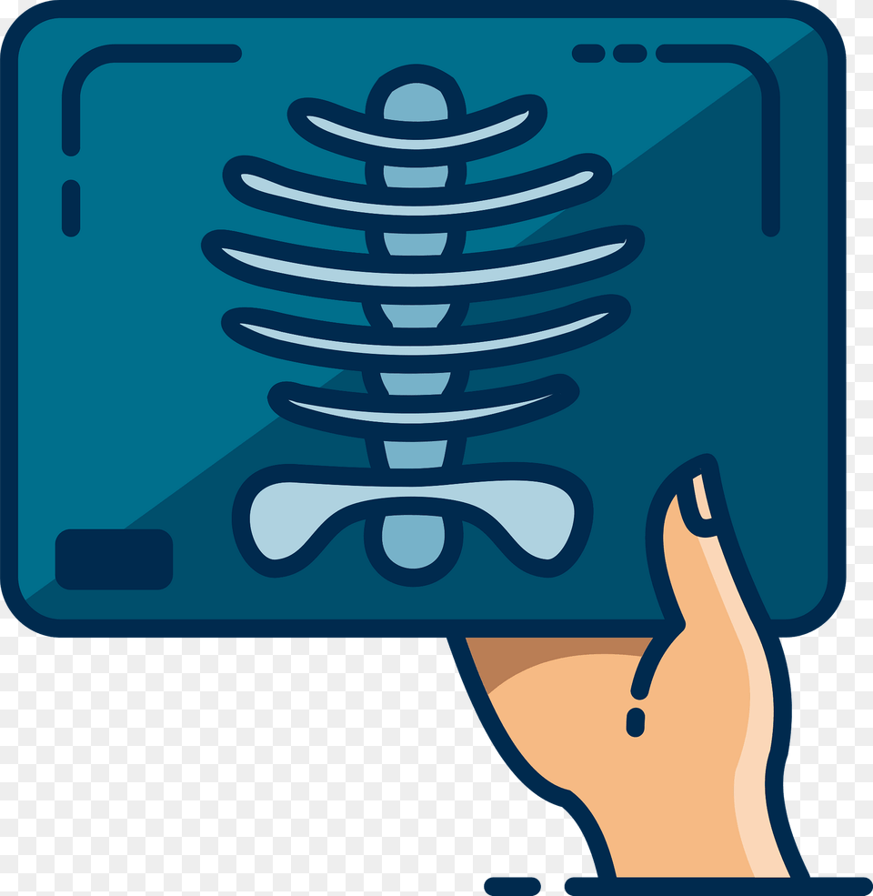 X Ray Clipart, Coil, Spiral Free Transparent Png
