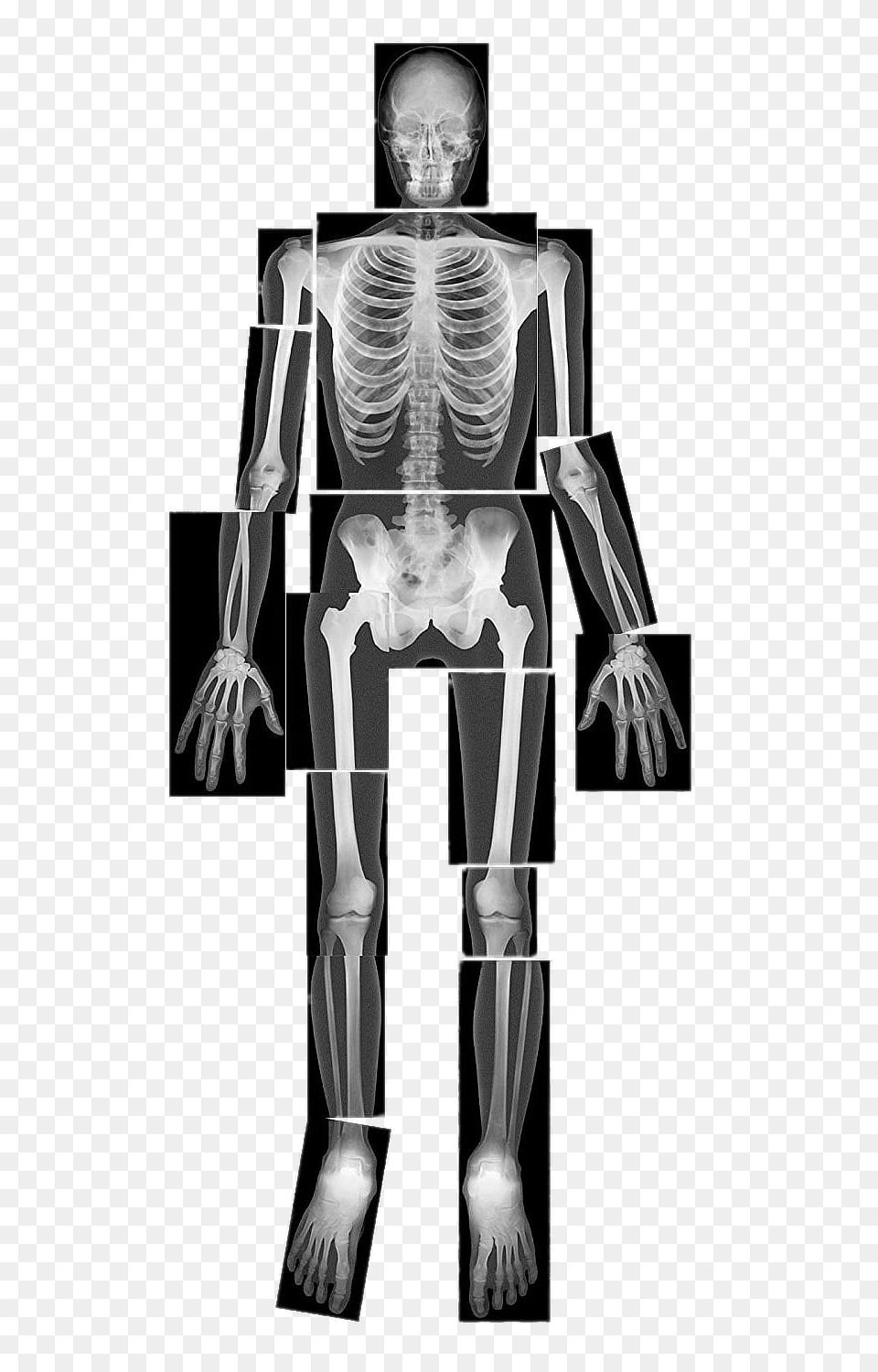 X Ray Of Full Body, X-ray, Face, Head, Person Png