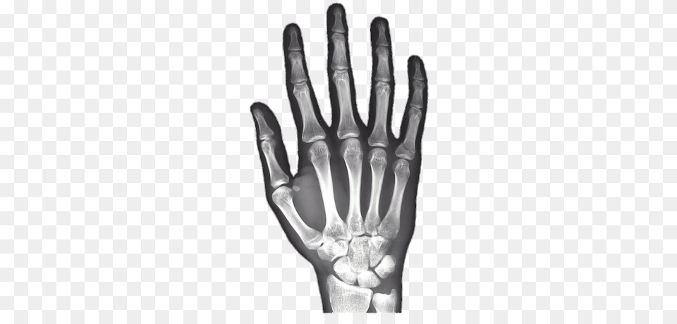 X Ray Of Hand, X-ray, Smoke Pipe Png Image