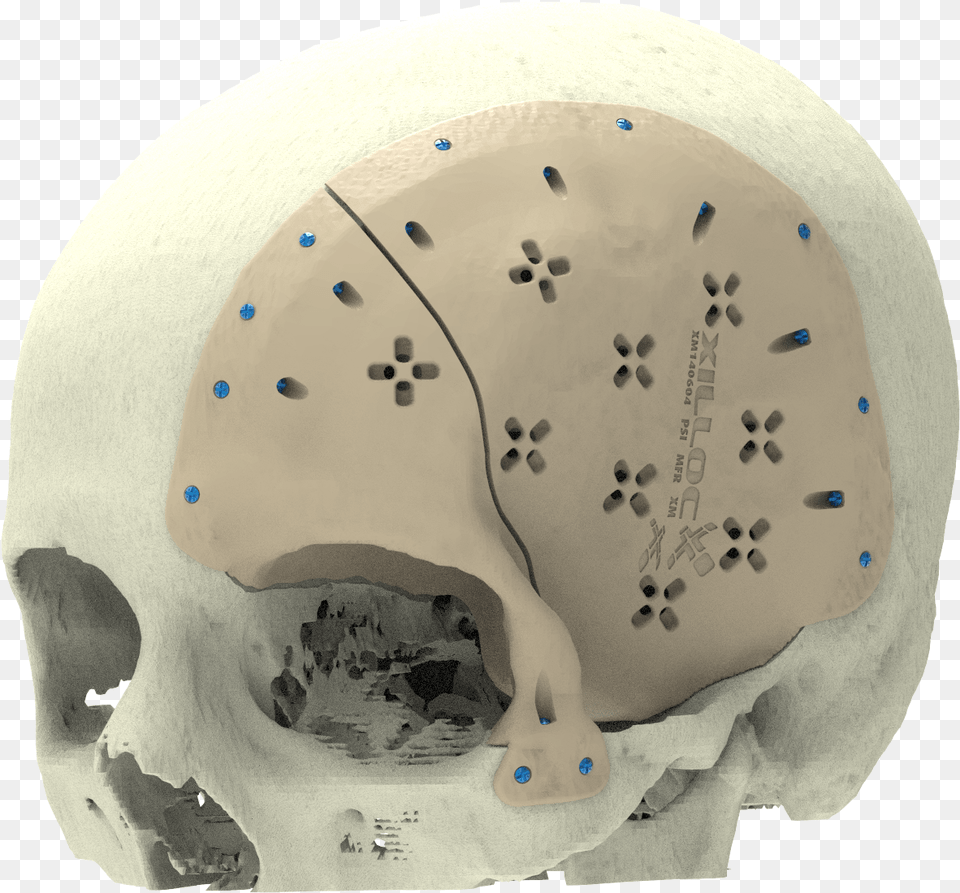 Xilloc Medical B Skull, Ct Scan Free Png