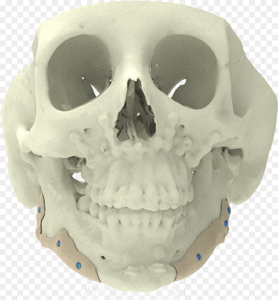Xilloc Medical B Skull, Ct Scan, Head, Person, Baby Png Image