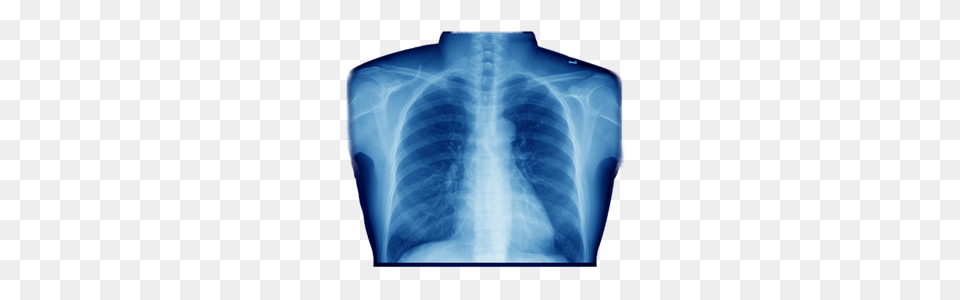 Xray, X-ray, Diaper, Ct Scan Free Png Download