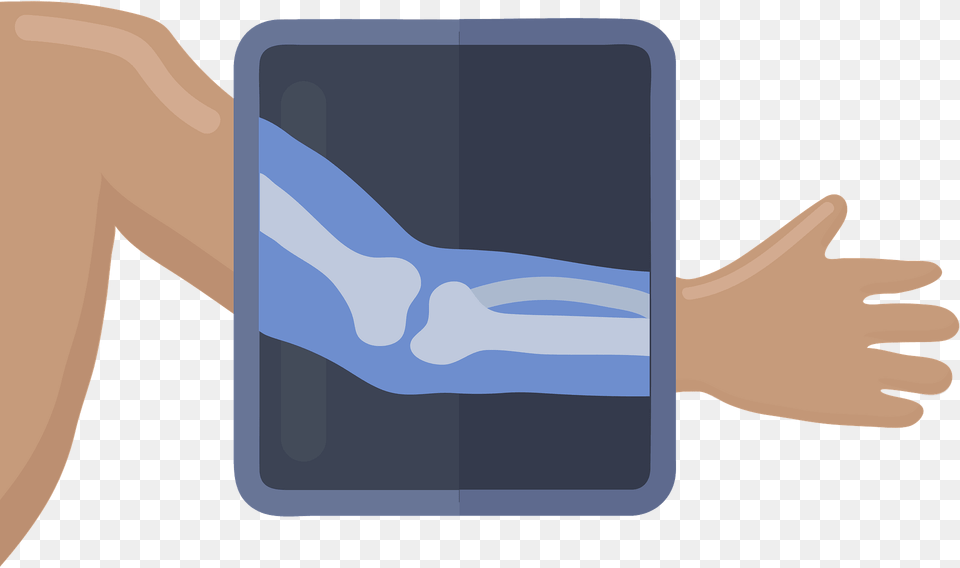 Xray Clipart, Computer, Electronics, Body Part, Hand Png Image
