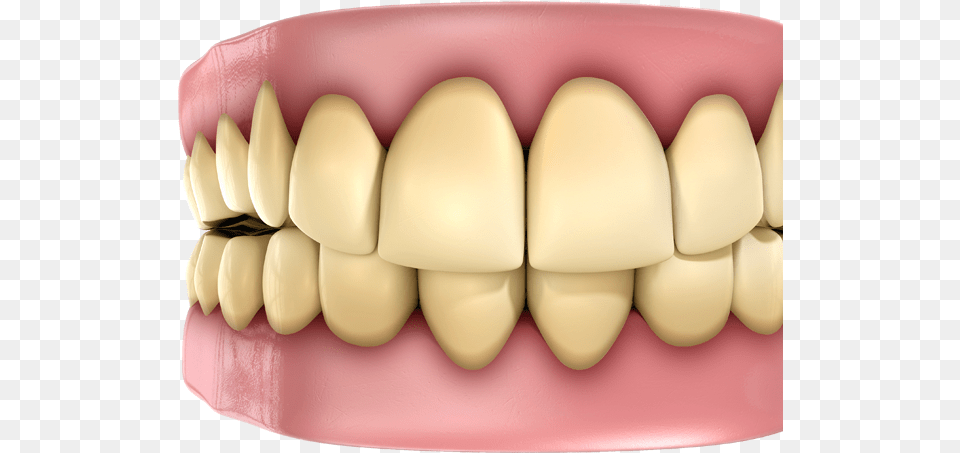 Yellow Teeth Fact And Myth About Health, Body Part, Mouth, Person, Face Free Transparent Png