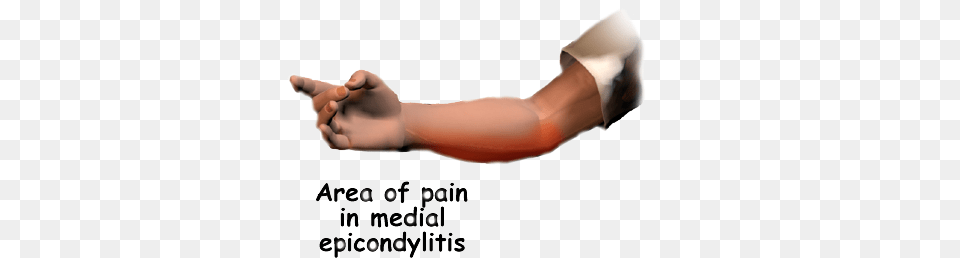 You May Feel Less Strength When Grasping Items Or Squeezing Medial Epicondylitis Golfer39s Elbow, Arm, Body Part, Person, Adult Free Png Download
